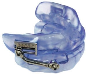 Photo of a blue oral appliance for relieveing sleep apnea - The Herbst, which is available from My Smile Artist in San Antonio.